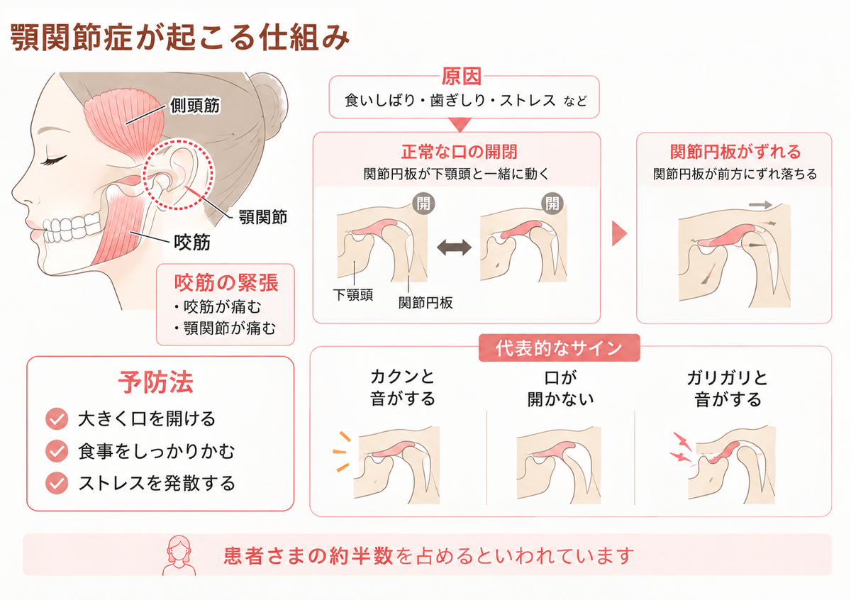 顎関節症とは？