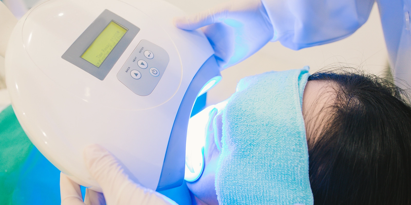 ホワイトニングの種類別値段相場