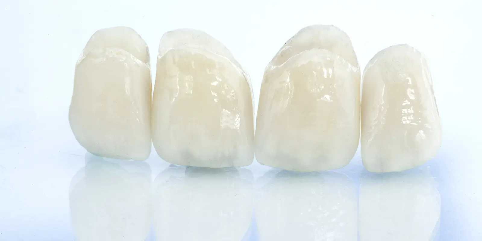 セラミック治療を成功させるポイント