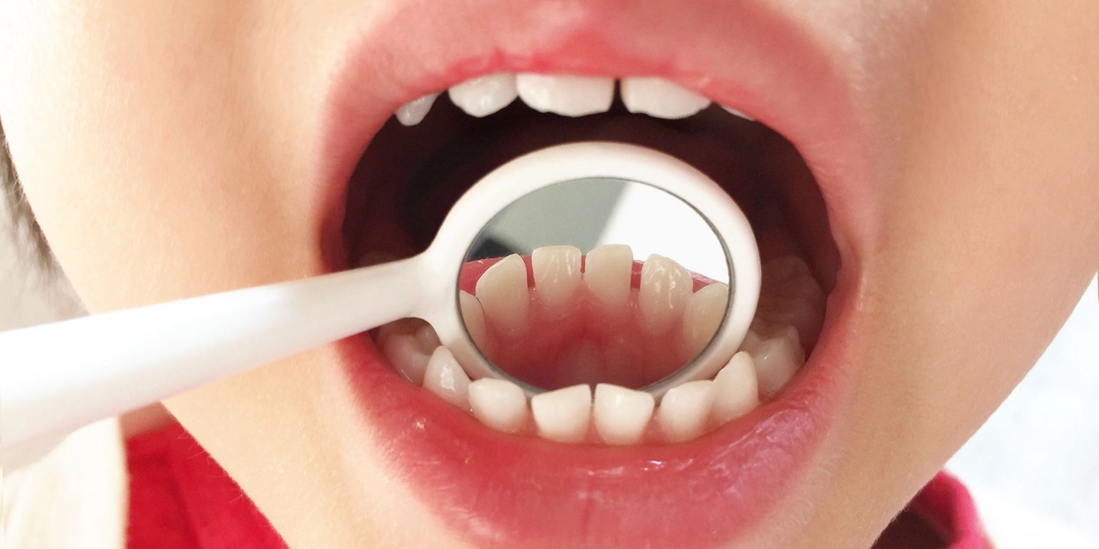 小児歯科で受けられる主な治療と予防処置