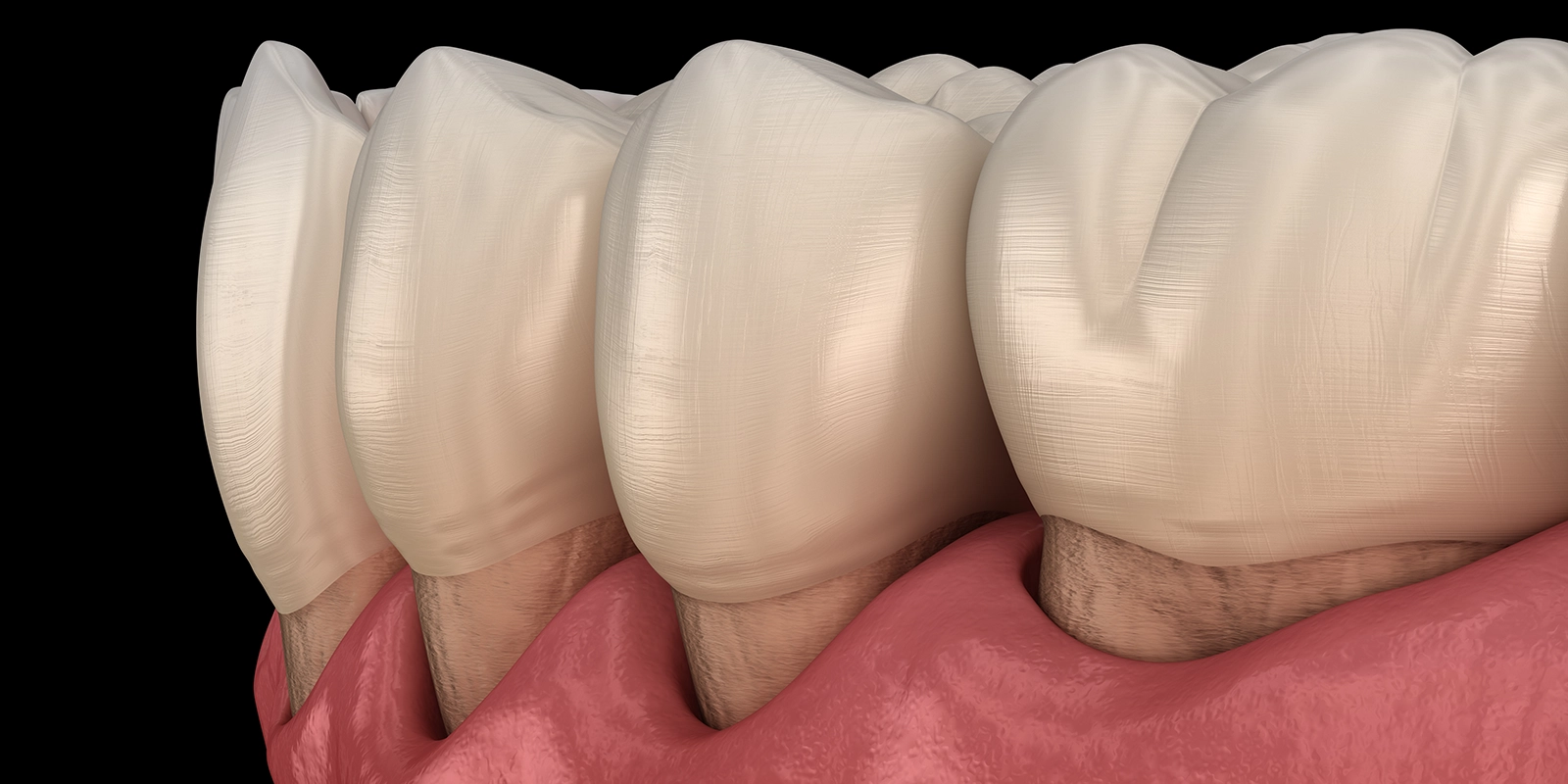 歯周病が糖尿病を悪化させるメカニズム—慢性炎症とインスリン抵抗性