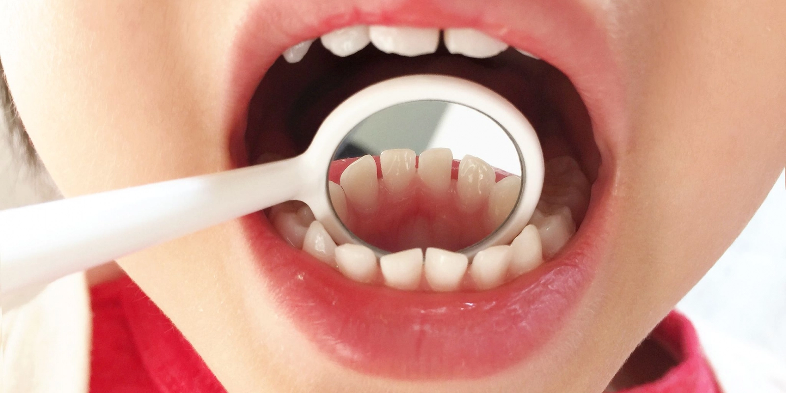 乳歯と永久歯の違い、なぜ「生え変わり」が必要なのか