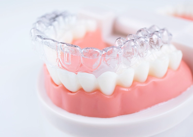 マウスガードの使用は子供の場合慎重な判断が必要